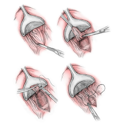 Proctologist Vascular Surgeon in Dubai